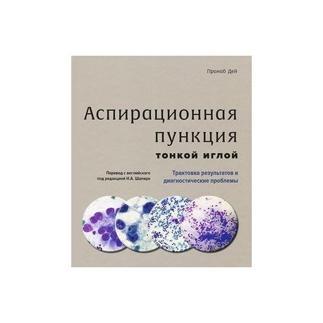 Аспирационная пункция тонкой иглой. Трактовка результатов и диагностические проблемы