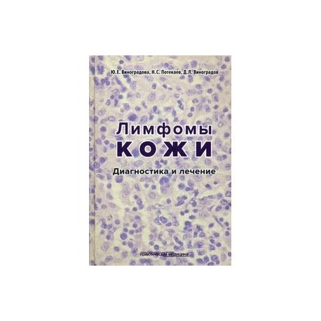 Лимфомы кожи. Диагностика и лечение