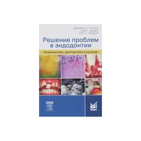 Решение проблем в эндодонтии. Профилактика, диагностика и лечение