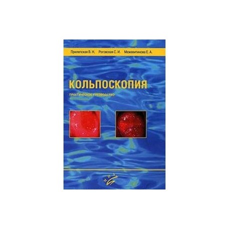 Кольпоскопия