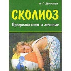 Сколиоз. Профилактика и лечение