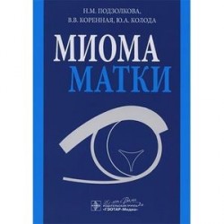 Миома матки