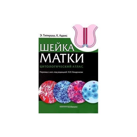 Шейка матки. Цитологический атлас.