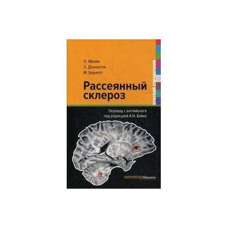 рассеянный склероз клинические синдромы. рассеянный склероз книги. болезнь рассеянный склероз. рассеянный склероз книги. демиелинизирующее заболевание головного.