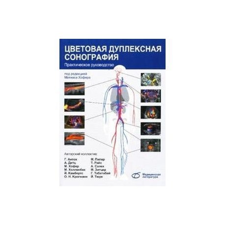 Цветовая дуплексная сонография. Практическое руководство