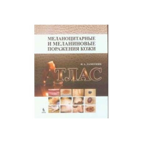 Меланоцитарные и меланиновые поражения кожи. Атлас