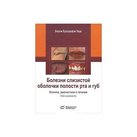 Болезни слизистой оболочки полости рта и губ. Клиника, диагностика и лечение