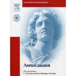 Липосакция (+DVD)