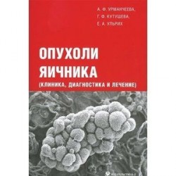 Опухоли яичника (клиника, диагностика и лечение)