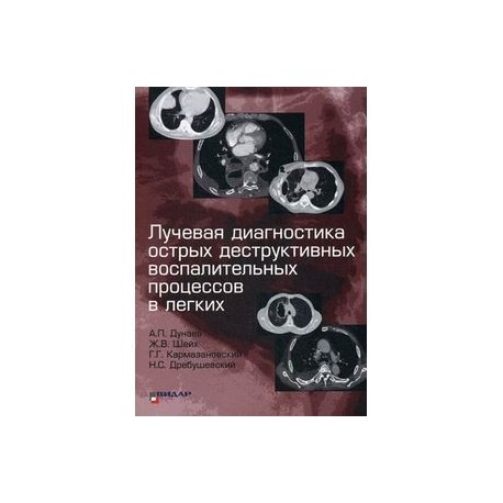 Лучевая диагностика острых деструктивных воспалительных процессов в легких