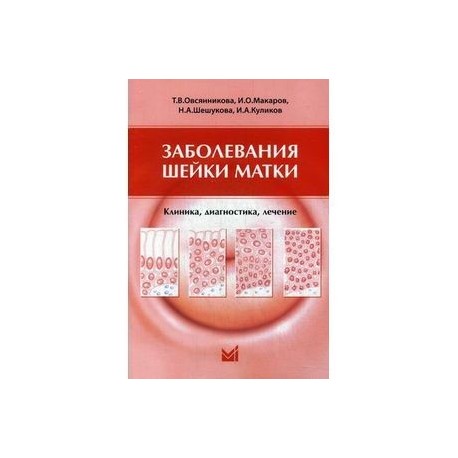 Заболевания шейки матки. Клиника, диагностика, лечение. Учебное пособие. Гриф УМО по медицинскому образованию