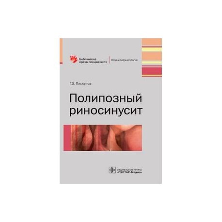 Полипозный риносинусит