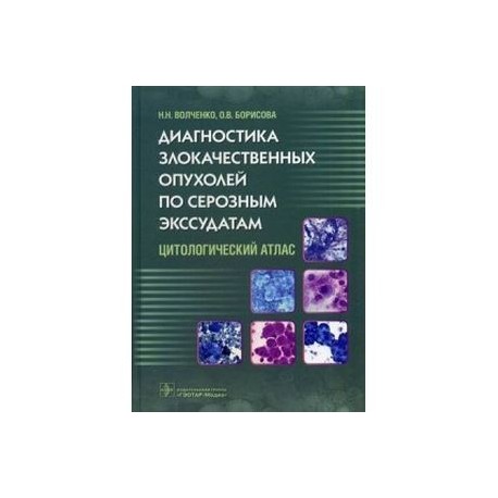 Диагностика злокачественных опухолей по серозным экссудатам. Цитологический атлас