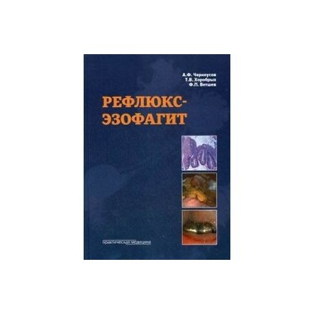 Рефлюкс - эзофагит