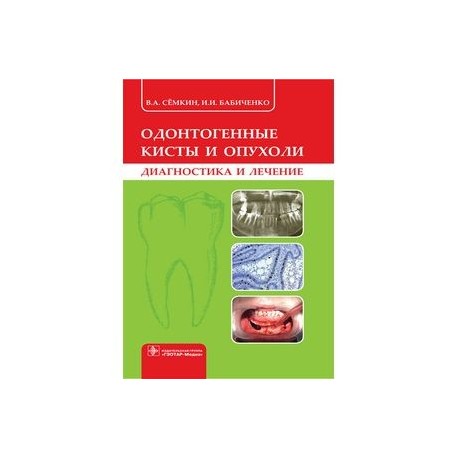 Одонтогенные кисты и опухоли. Диагностика и лечение