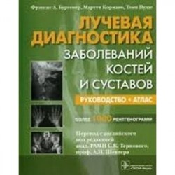 Лучевая диагностика заболеваний костей и суставов