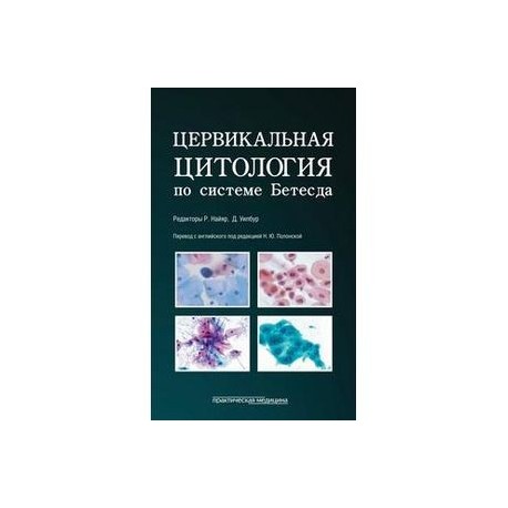 Цервикальная цитология по системе Бетесда. Терминология, критерии и пояснения