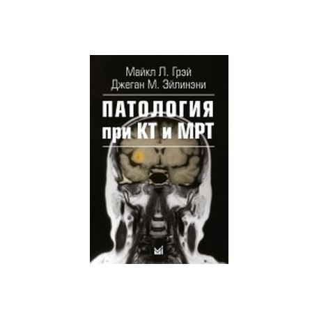 Патология при КТ и МРТ