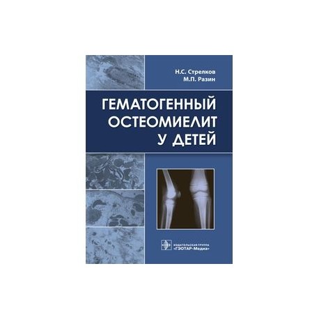 Гематогенный остеомиелит у детей