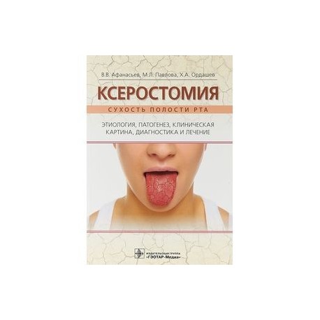 Ксеростомия. Сухость полости рта. Этиология, патогенез, клиническая картина, диагностика и лечение