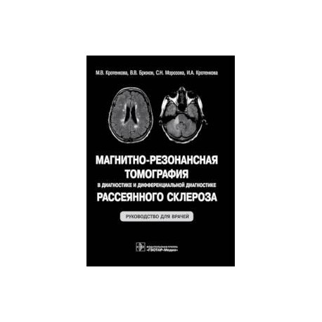 Магнитно-резонансная томография в диагностике и дифференциальной диагностике рассеянного склероза