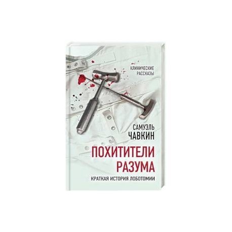 Похитители разума. Краткая история лоботомии