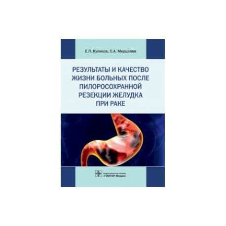 Результаты и качество жизни больных после пилоросохранной резекции желудка при раке