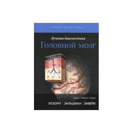 Лучевая диагностика. Головной мозг