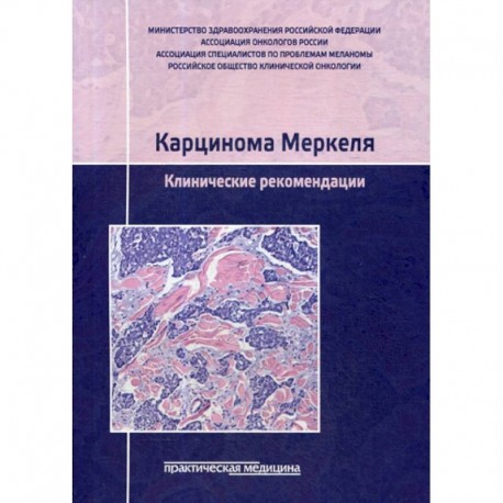 Карцинома Меркеля. Клинические рекомендации