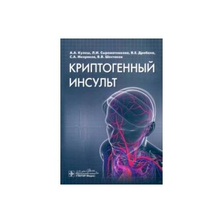 Криптогенный инсульт. Ишемический криптогенный инсульт. Криптогенный эмболический инсульт. ОНМК криптогенный Подтип.