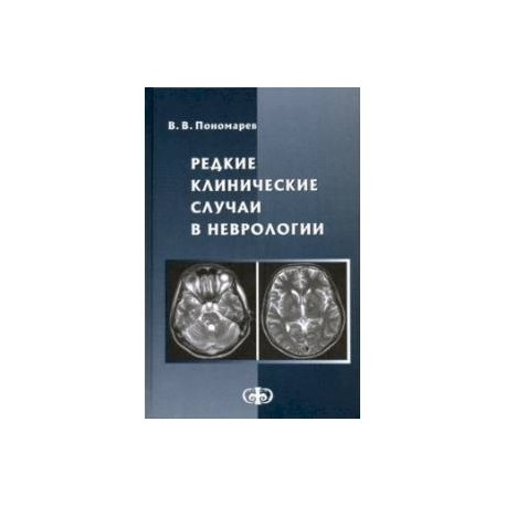 Редкие клинические случаи в неврологии (случаи из практики). Руководство для врачей