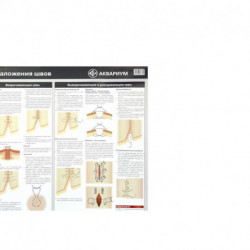 Плакат 'Техника наложения швов' 84х59 см. (в тубусе)