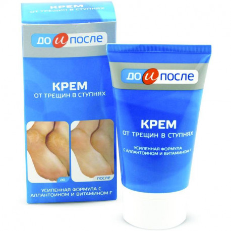 ДО и После крем от трещин в ступнях 150мл