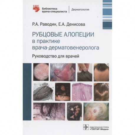 Рубцовые алопеции в практике врача-дерматовенеролога. Руководство для врачей