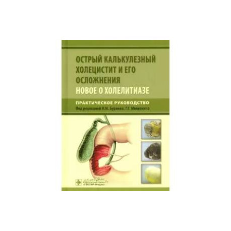 Острый калькулезный холецистит и его осложнения. Новое о холелитиазе. Практическое руководство