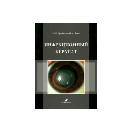 Инфекционный кератит. Учебное пособие