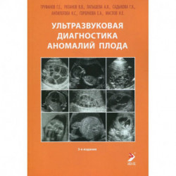 Ультразвуковая диагностика аномалий плода: Руководство для врачей