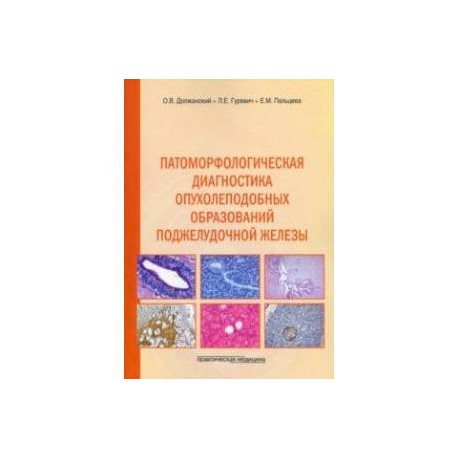 Патоморфологическая диагностика опухолеподобных образований поджелудочной железы. Руководство