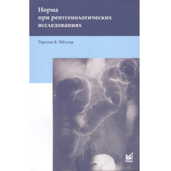 Норма при рентгенологических исследованиях . Мёллер Т.Б.