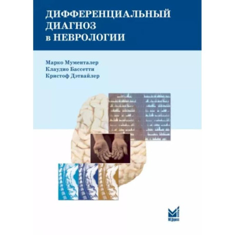 Дифференциальный диагноз в неврологии. Руководство по оценке, классификации и дифференциональной диагностике