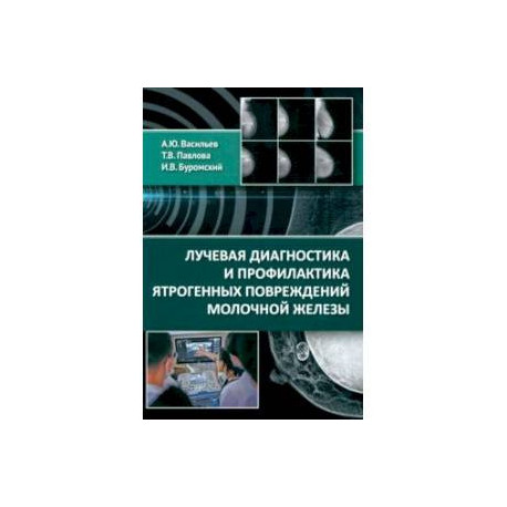 Лучевая диагностика и профилактика ятрогенных повреждений молочной железы