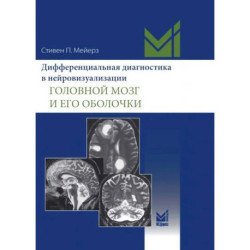Дифференциальная диагностика в нейровизуализации. Головной мозг и его оболочки