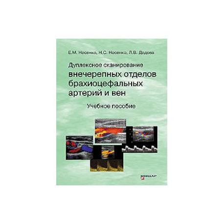 Дуплексное сканирование внечерепных отделов брахиоцефальных артерий и вен: Учебное пособие