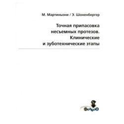 Точная припасовка несъемных протезов. Клинические и зуботехнические этапы