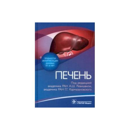 Трудности интерпретации данных КТ и МРТ. Печень