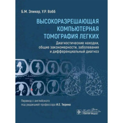 Высокоразрешающая компьютерная томография легких. Диагностические находки, общие закономерности, заболевания и