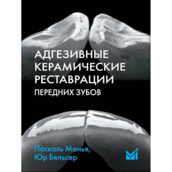 Адгезивные керамические реставрации передних зубов