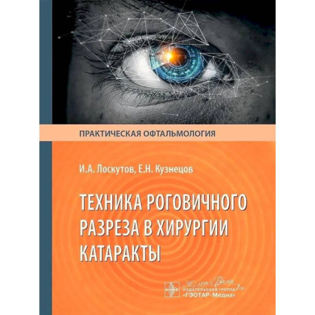 Техника роговичного разреза в хирургии катаракты