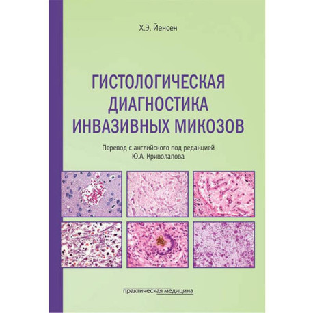 Гистологическая диагностика инвазивных микозов