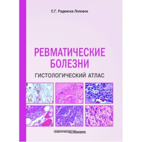 Ревматические болезни. Гистологический атлас